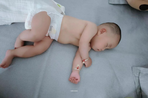 利津六个月宝宝眼睛散光